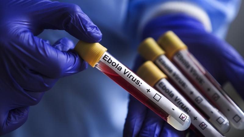 Ebola virus