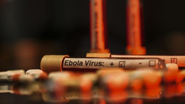Ebola virusu